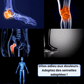 Semelles Orthopédiques FitSole® | Zéro Douleur, 100% Confort